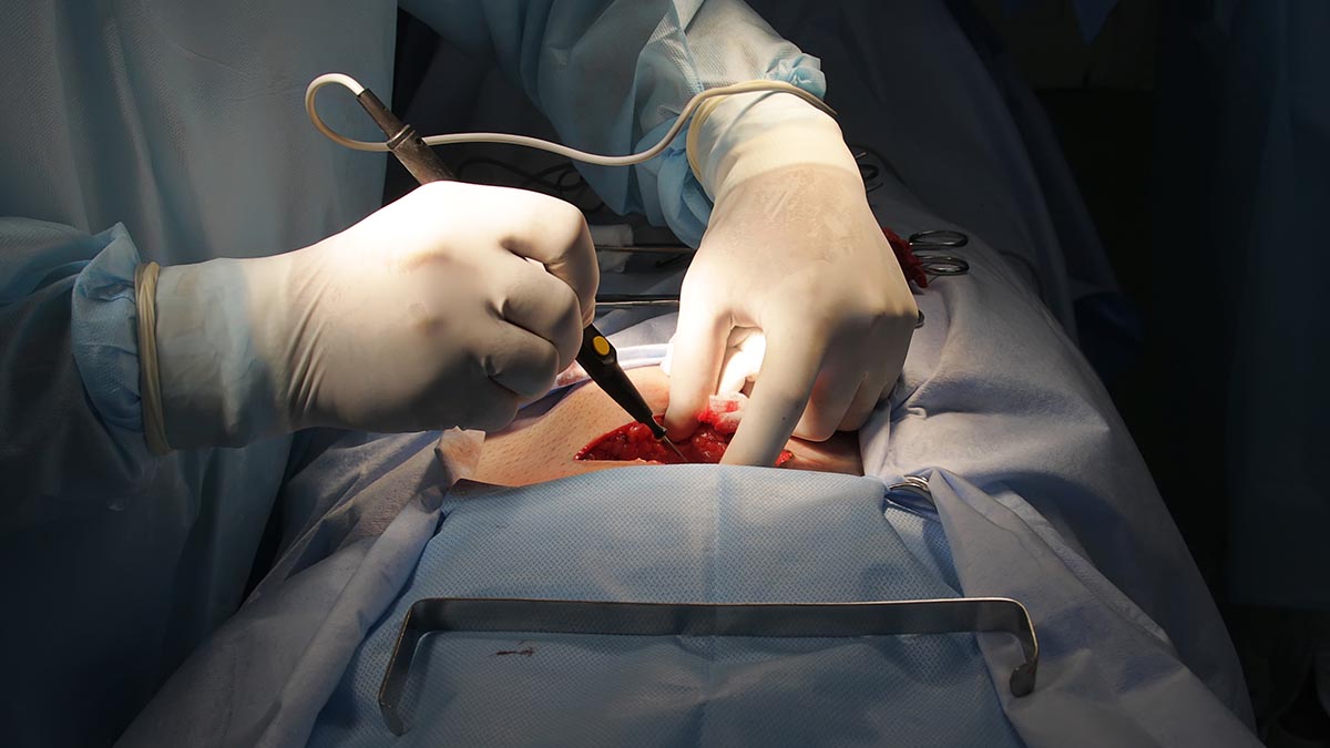 best general surgeon in bangalore	