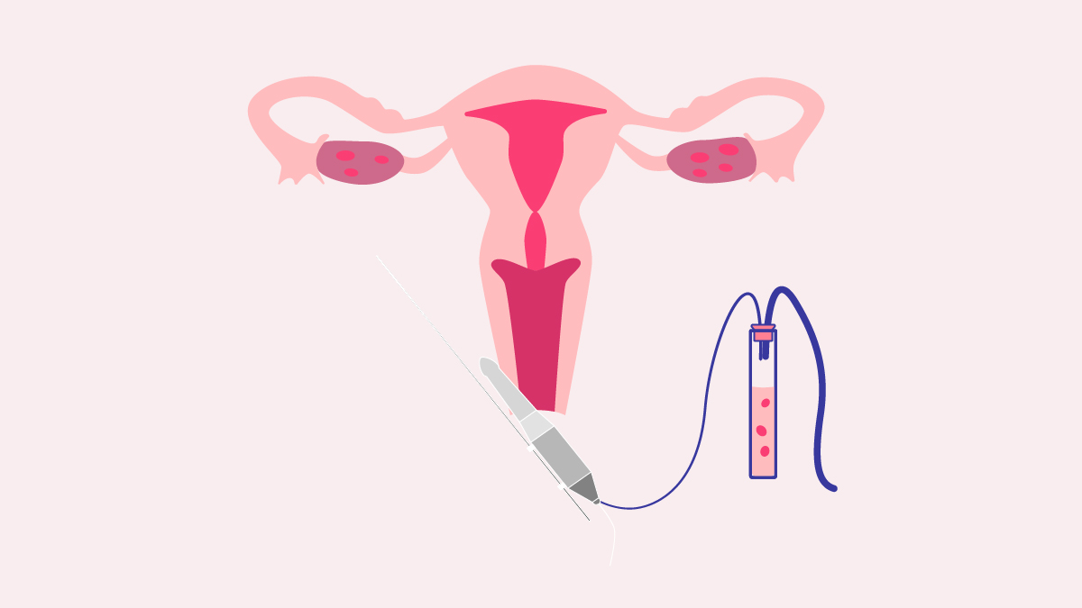 best IVF specialist in Bangalore