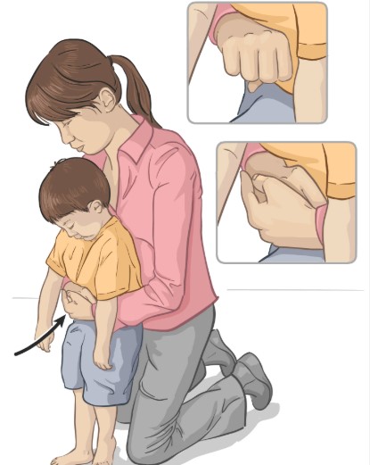 Pediatric emergency for swallowed items